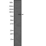 Phospho-DNM1L (Ser616) Polyclonal Antibody