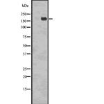 Phospho-EGFR (Tyr998) Antibody in Western Blot (WB)