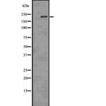 Phospho-53BP1 (Thr543) Antibody in Western Blot (WB)