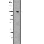 Phospho-beta Catenin (Ser33, Ser37, Thr41) Antibody in Western Blot (WB)