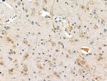 Phospho-FADD (Ser194) Antibody in Immunohistochemistry (Paraffin) (IHC (P))