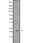 Phospho-FADD (Ser194) Antibody in Western Blot (WB)