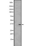 Nkx6.3 Polyclonal Antibody