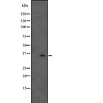 FOXE1 Polyclonal Antibody