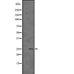 GSC2 Polyclonal Antibody