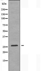 ANP32C Polyclonal Antibody