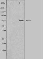 AKAP8 Polyclonal Antibody