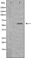 DKC1 Polyclonal Antibody