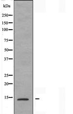 PFDN1 Polyclonal Antibody