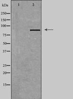 TACC1 Polyclonal Antibody