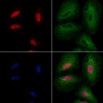 ALX3 Polyclonal Antibody