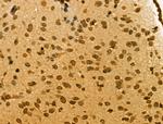 ALX3 Antibody in Immunohistochemistry (Paraffin) (IHC (P))