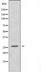 LRAT Polyclonal Antibody