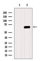 HEXB Polyclonal Antibody