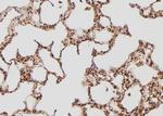 TPT1 Polyclonal Antibody