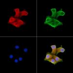 UBF-1 Polyclonal Antibody