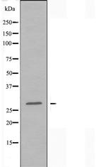 HOXB9 Antibody in Western Blot (WB)