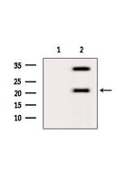 ATF3 Antibody in Western Blot (WB)