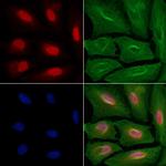 CDK11B Polyclonal Antibody