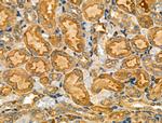 PKA gamma Polyclonal Antibody