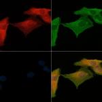 PTX3 Polyclonal Antibody