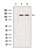 ITPKB Polyclonal Antibody