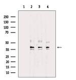 GTF2E2 Polyclonal Antibody