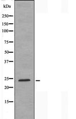 HOXA7 Polyclonal Antibody