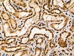 CIITA Polyclonal Antibody