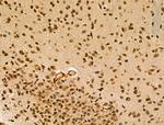 CIITA Antibody in Immunohistochemistry (Paraffin) (IHC (P))