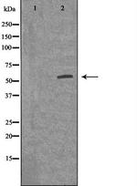 ACVR1B Polyclonal Antibody