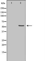 ETV6 Polyclonal Antibody