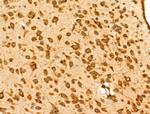 GRK6 Polyclonal Antibody