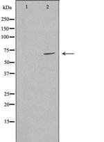 GRK6 Antibody in Western Blot (WB)