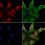 CLK1 Polyclonal Antibody