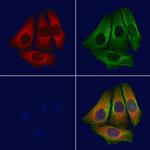 BAP31 Polyclonal Antibody