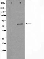 DGKE Polyclonal Antibody