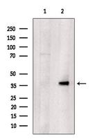 ZNF134 Polyclonal Antibody
