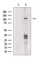 DGKQ Polyclonal Antibody