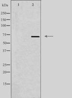 LIMK2 Polyclonal Antibody