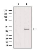 AMPK gamma-1,2,3 Polyclonal Antibody