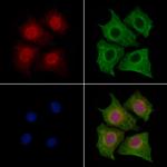 LMO4 Polyclonal Antibody