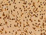 PITX1 Antibody in Immunohistochemistry (Paraffin) (IHC (P))