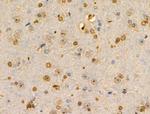 PITX1 Antibody in Immunohistochemistry (Paraffin) (IHC (P))