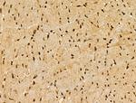 CDKL1 Polyclonal Antibody