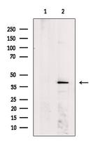MVK Polyclonal Antibody