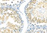 CAF1 p60 Antibody in Immunohistochemistry (Paraffin) (IHC (P))