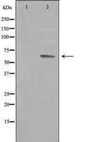 GTF2H2 Polyclonal Antibody