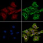 MELK Polyclonal Antibody