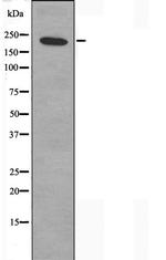 ZNF638 Polyclonal Antibody